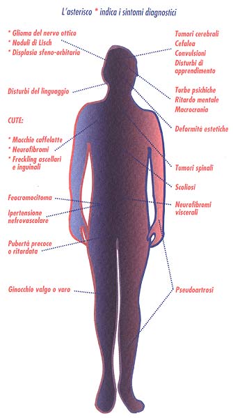 cos'è la neurofibromatosi